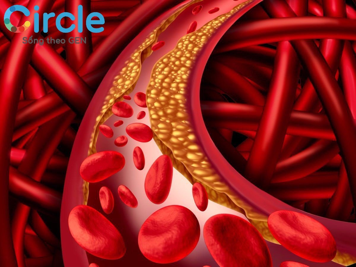 Cholesterol thực chất có 2 loại, 1 tốt và 1 xấu.