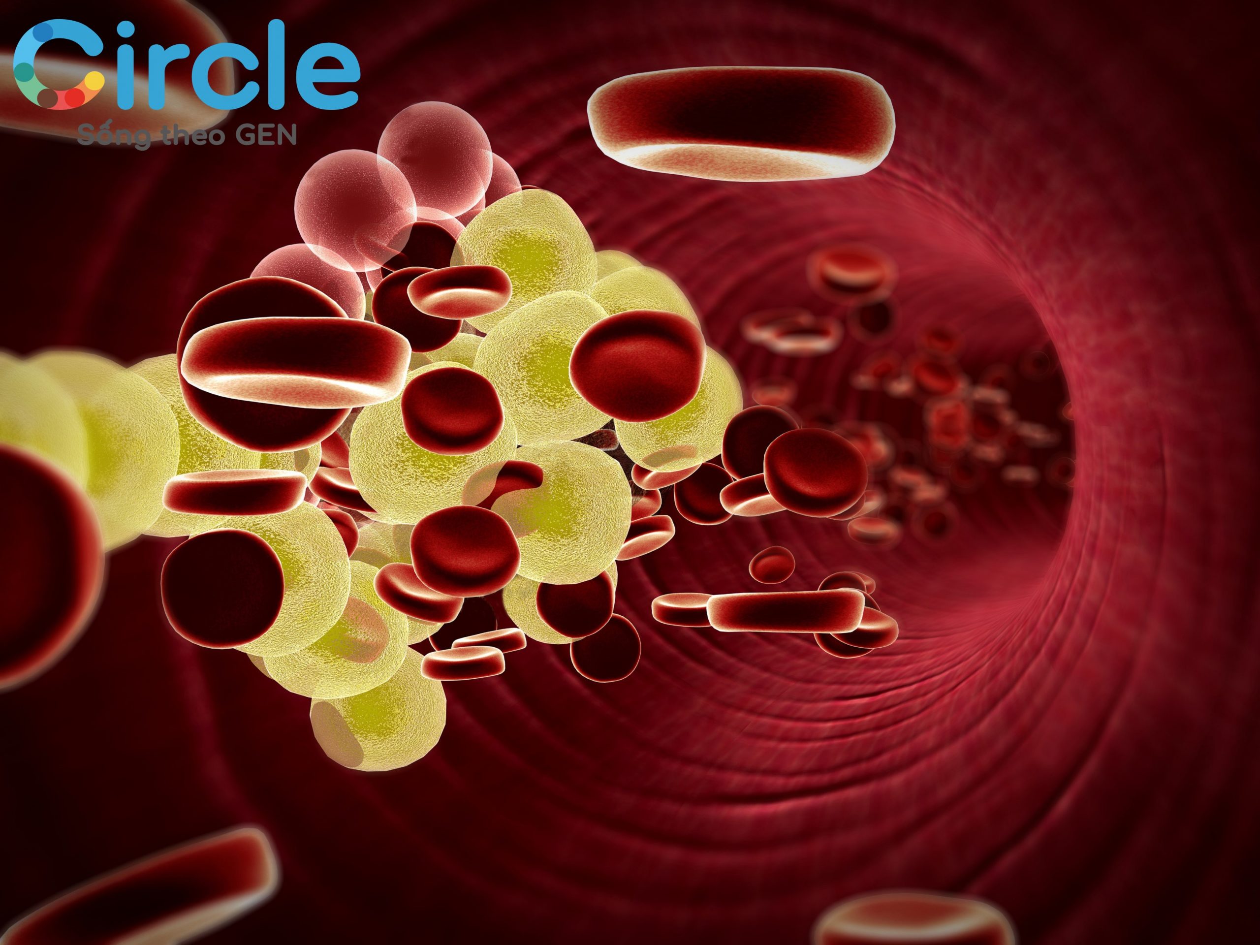 Việc để nồng độ cholesterol trong máu cao ngoài mức kiểm soát sẽ gây ra những biến chứng vô cùng nguy hiểm.