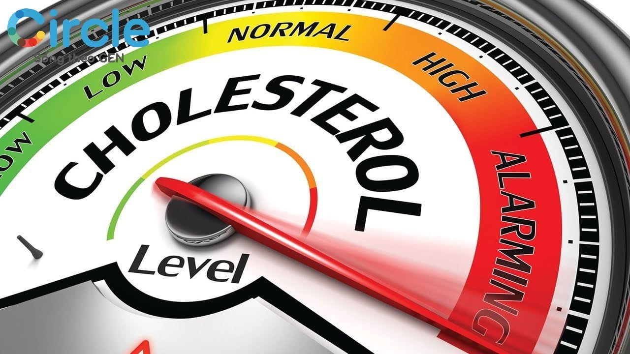 Tăng cholesterol thường chỉ biểu hiện thành triệu chứng khi mức độ cholesterol, nồng độ cholesterol trong máu cao và đã tăng tới mức báo động.
