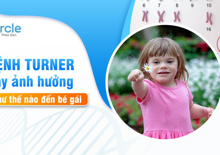 Bệnh Turner gây ảnh hưởng như thế nào đến bé gái